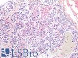 Alpha-Fetoprotein Antibody - Human Liver, Hepatocellular Carcinoma: Formalin-Fixed, Paraffin-Embedded (FFPE)