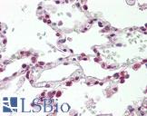 ASCL1 / MASH1 Antibody - Anti-ASCL1 / MASH1 antibody IHC staining of human lung. Immunohistochemistry of formalin-fixed, paraffin-embedded tissue after heat-induced antigen retrieval.