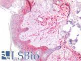B2M / Beta 2 Microglobulin Antibody - Human Skin: Formalin-Fixed, Paraffin-Embedded (FFPE)