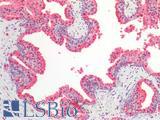 BAD Antibody - Human Prostate: Formalin-Fixed, Paraffin-Embedded (FFPE)