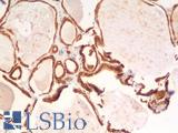 BCL2 / Bcl-2 Antibody - Human Thyroid: Formalin-Fixed, Paraffin-Embedded (FFPE)