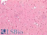 BECN1 / Beclin-1 Antibody - Human Brain, Cortex: Formalin-Fixed, Paraffin-Embedded (FFPE)