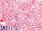 BECN1 / Beclin-1 Antibody - Human Kidney: Formalin-Fixed, Paraffin-Embedded (FFPE)