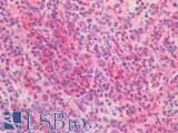 BRAF / B-Raf Antibody - Human Spleen: Formalin-Fixed, Paraffin-Embedded (FFPE)