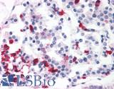 BRS3 Antibody - Pancreas, Islets of Langerhans