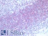 BTLA / CD272 Antibody - Human Tonsil Marginal Zone: Formalin-Fixed, Paraffin-Embedded (FFPE)