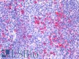 BTLA / CD272 Antibody - Human Tonsil: Formalin-Fixed, Paraffin-Embedded (FFPE)