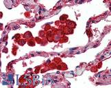 CASP12 / Caspase 12 Antibody - Anti-CASP12 / Caspase 12 antibody IHC of human lung. Immunohistochemistry of formalin-fixed, paraffin-embedded tissue after heat-induced antigen retrieval. Antibody concentration 5 ug/ml.