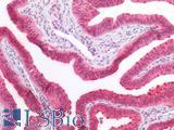 CCDC6 Antibody - Human Fallopian Tube: Formalin-Fixed, Paraffin-Embedded (FFPE)