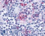CCR10 / GPR2 Antibody - Lymph node, lymphocytes