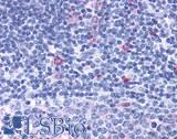 CCR7 Antibody - tonisl, mantle zone lymphocytes 