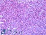 CCR7 Antibody - Human Tonsil: Formalin-Fixed, Paraffin-Embedded (FFPE)