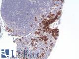 CD20 Antibody - Human Thymus: Formalin-Fixed, Paraffin-Embedded (FFPE)