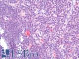 CD274 / B7-H1 / PD-L1 Antibody - Human Thymus: Formalin-Fixed, Paraffin-Embedded (FFPE)