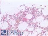 CD36 Antibody - Human Bone, Megakaryocyte: Formalin-Fixed, Paraffin-Embedded (FFPE)