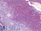 CD38 Antibody - Human Thymus: Formalin-Fixed, Paraffin-Embedded (FFPE)