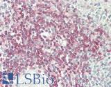 CD4 Antibody - Human Spleen, lymphocytes: Formalin-Fixed, Paraffin-Embedded (FFPE)