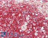 CD44 Antibody - Human Spleen, germinal center lymphocytes: Formalin-Fixed, Paraffin-Embedded (FFPE)