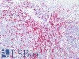 CD45RO Antibody - Human Tonsil: Formalin-Fixed, Paraffin-Embedded (FFPE)