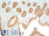 CDH1 / E Cadherin Antibody - Human Small Intestine: Formalin-Fixed, Paraffin-Embedded (FFPE)