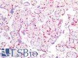 CDKN1C / p57 Kip2 Antibody - Human Placenta: Formalin-Fixed, Paraffin-Embedded (FFPE)