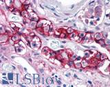 CELSR2 Antibody - Brain, Pituitary