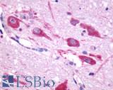 CHRM5 / M5 Antibody - Brain, Hypothalamus, Ventromedial nucleus