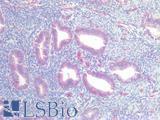 CLDN5 / Claudin 5 Antibody - Human Uterus: Formalin-Fixed, Paraffin-Embedded (FFPE)