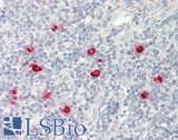 CMA1 / Mast Cell Chymase Antibody - Human Tonsil: Formalin-Fixed, Paraffin-Embedded (FFPE).  This image was taken for the unconjugated form of this product. Other forms have not been tested.