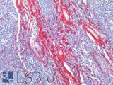 COL1A1 / Collagen I Alpha 1 Antibody - Human Tonsil: Formalin-Fixed, Paraffin-Embedded (FFPE)