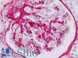 Collagen IV Antibody - Human, Kidney, glomerulus: Formalin-Fixed Paraffin-Embedded (FFPE)