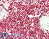 CORO1A / Coronin 1a Antibody - Human Spleen: Formalin-Fixed, Paraffin-Embedded (FFPE)