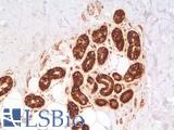 CTNNB1 / Beta Catenin Antibody - Human Skin: Formalin-Fixed, Paraffin-Embedded (FFPE)