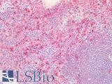 CTSB / Cathepsin B Antibody - Human Spleen: Formalin-Fixed, Paraffin-Embedded (FFPE)