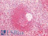CTSV / Cathepsin V Antibody - Human Spleen: Formalin-Fixed, Paraffin-Embedded (FFPE)