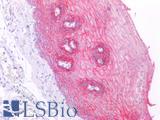 DSG3 / Desmoglein 3 Antibody - Human Esophagus: Formalin-Fixed, Paraffin-Embedded (FFPE)
