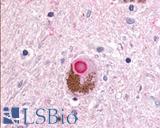 DUSP22 / JSP 1 Antibody - Brain, Parkinson's Disease, Neuron Lewy Body