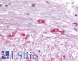 DUSP22 / JSP 1 Antibody - Brain, Oligodendrocytes