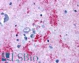 EDNRB / Endothelin B Receptor Antibody - Brain, Alzheimer's senile plaque