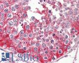 EFNB2 / Ephrin B2 Antibody - Human Testis: Formalin-Fixed, Paraffin-Embedded (FFPE)