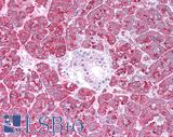 EMA / MUC1 Antibody - Human Pancreas: Formalin-Fixed, Paraffin-Embedded (FFPE)
