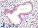 ER Alpha / Estrogen Receptor Antibody - Human Uterus: Formalin-Fixed, Paraffin-Embedded (FFPE)
