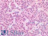 ER Alpha / Estrogen Receptor Antibody - Human Breast Carcinoma: Formalin-Fixed, Paraffin-Embedded (FFPE)