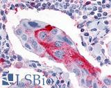 ESRRG / ERR Gamma Antibody - Breast, Carcinoma