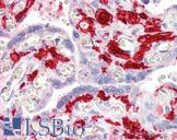 F13A1 / Factor XIIIa Antibody - Anti-F13A1 / Factor XIIIa antibody IHC of human placenta. Immunohistochemistry of formalin-fixed, paraffin-embedded tissue after heat-induced antigen retrieval. Antibody concentration 5 ug/ml.