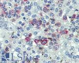 FASLG / Fas Ligand Antibody - Anti-FASLG / FASL antibody IHC of human spleen. Immunohistochemistry of formalin-fixed, paraffin-embedded tissue after heat-induced antigen retrieval. Antibody concentration 10 ug/ml.