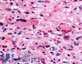 FFAR2 / GPR43 Antibody - Brain, Glioblastoma