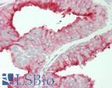 FOLH1 / PSMA Antibody - Human Prostate: Formalin-Fixed, Paraffin-Embedded (FFPE)
