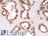 FOXA1 Antibody - Human Prostate: Formalin-Fixed, Paraffin-Embedded (FFPE)