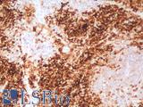 FTL / Ferritin Light Chain Antibody - Human Spleen: Formalin-Fixed, Paraffin-Embedded (FFPE)